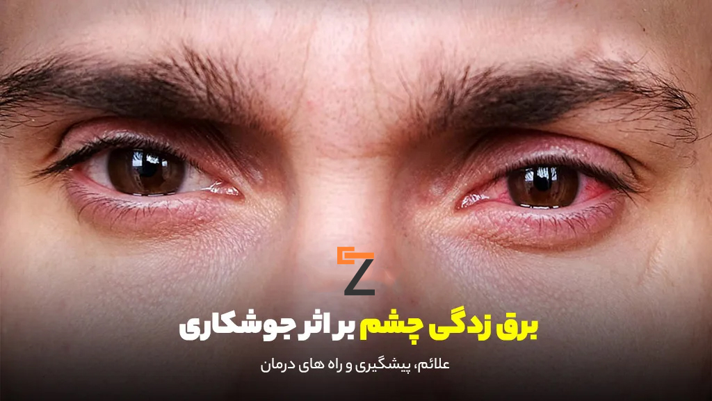 eye000